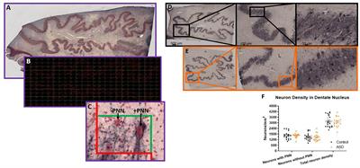 Region-Specific Alterations of Perineuronal Net Expression in Postmortem Autism Brain Tissue